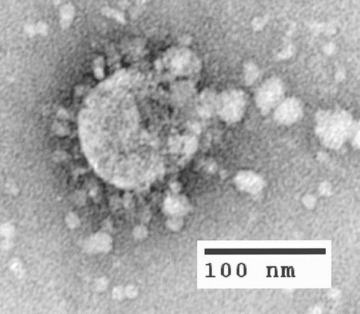 Electron micrograph of SARS-coronavirus, 2003. Image obtained from the CDC public health image library, ID # 3467